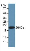 EPO / Erythropoietin Antibody