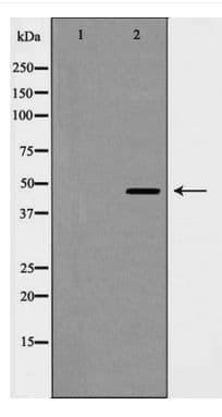 CCNE2 / Cyclin E2 Antibody