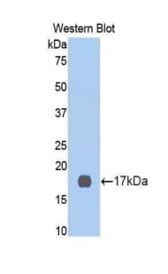 CDK2 Antibody (aa94-212)