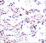Polyclonal Rabbit anti-Human JUN / c-Jun Antibody (IHC, WB)