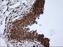 RTKN / Rhotekin Antibody (clone OTI2E9)