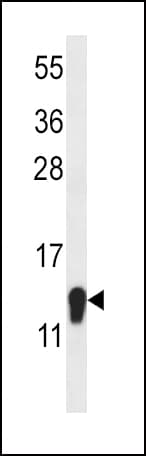SZRD1 / C1orf144 Antibody (aa7-36)