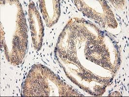 RASSF1 / RASSF1A Antibody (clone OTI2B11)