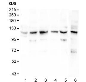 Polyclonal Rabbit anti-Human Anillin Antibody (WB)