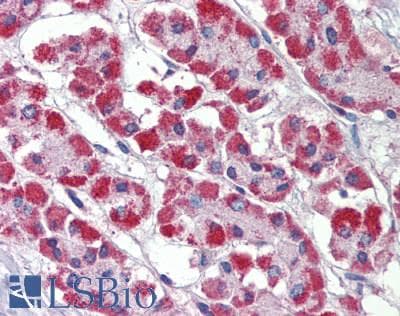 IHC-plus™ Polyclonal Rabbit anti-Human Prohibitin 2 / PHB2 Antibody (Tyr128, IHC, WB)