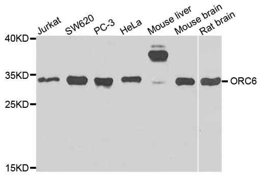 IHC-plus™ ORC6 / ORC6L Antibody