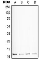 SST / Somatostatin Antibody (N-Terminus)