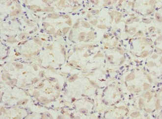 Polyclonal Rabbit anti-Human VANGL2 / LTAP Antibody (IHC, WB)