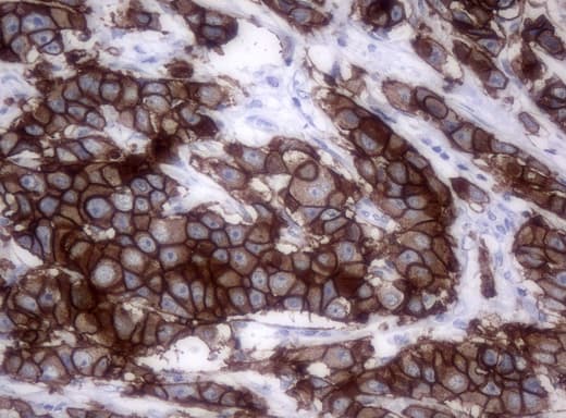 ERBB2 / HER2 Antibody (aa676-1255, clone UMAB33)