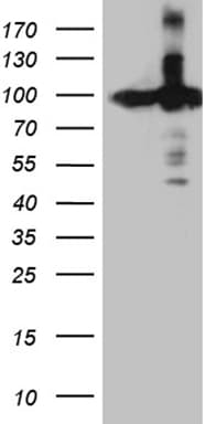 KPNB1 / Importin Beta Antibody (aa1-200, clone OTI6H3)