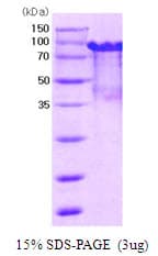 Mouse PRMT1 Protein (Recombinant His)