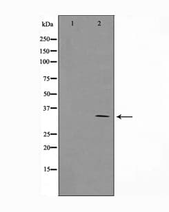 CCND1 / Cyclin D1 Antibody