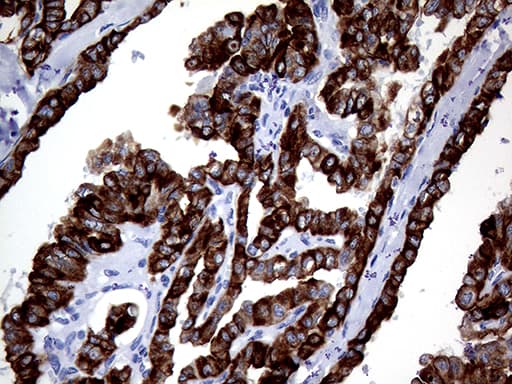 KRT8 / CK8 / Cytokeratin 8 Antibody (aa91-381, clone OTI2F5)