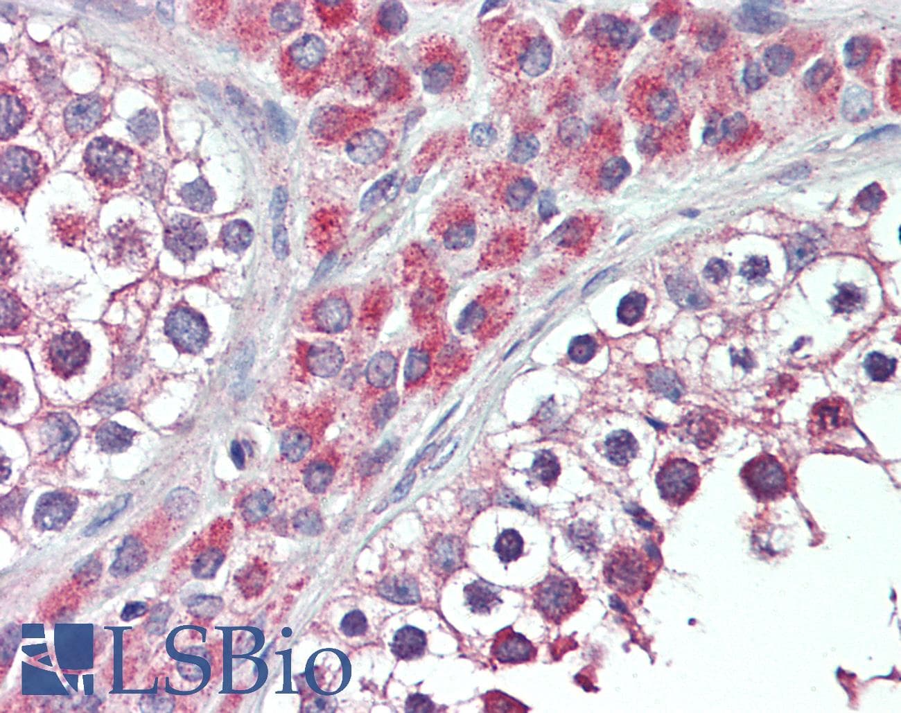 IHC-plus™ Polyclonal Rabbit anti-Human INHBB / Inhibin Beta B Antibody (aa369-397, IHC, WB)