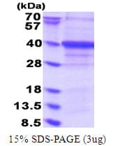 Human ETS2 Protein (Recombinant His)