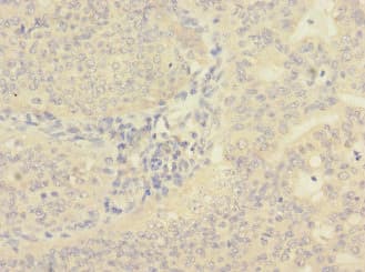 CIR1 Antibody