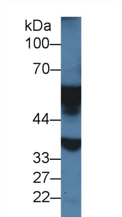MAOA / Monoamine Oxidase Antibody (aa1-497, PE)
