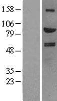 Human HGF / Hepatocyte Growth Factor Protein (Over-Expression Lysate Myc-DDK (Flag))