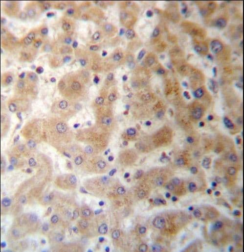 Polyclonal Rabbit anti-Human DHFRL1 Antibody (aa45-74, IHC, WB)