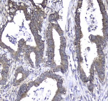 L1CAM Antibody