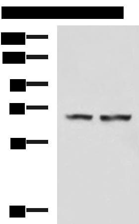 TOCA1 / FNBP1L Antibody