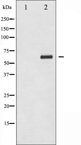 Polyclonal Rabbit anti-Human CHEK2 / CHK2 Antibody (phospho-Thr383, IHC, IF, WB)