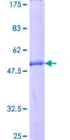 Human MIS12 Protein (Recombinant GST)