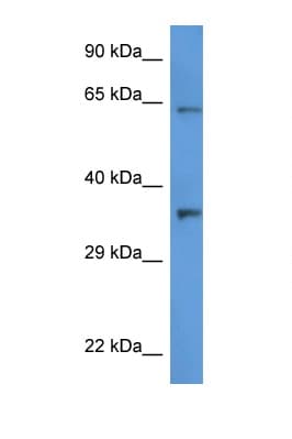 CTSV / Cathepsin V Antibody (aa181-230)