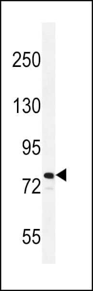 Polyclonal Rabbit anti-Human RAD54L Antibody (aa634-663, WB)