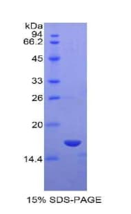 Rat IL15 Protein (Recombinant His)
