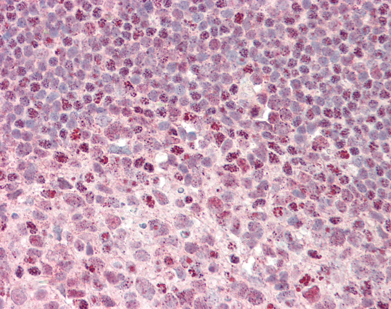EEF1D Antibody (aa160-209)