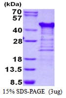 Human TTC1 Protein (Recombinant His)