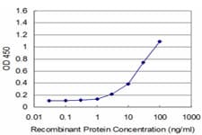 CELA3A / ELA3 Antibody (clone 3G4)