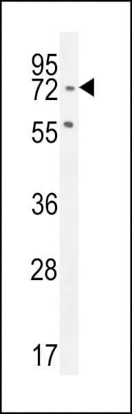 Polyclonal Rabbit anti-Human SLFN12L Antibody (aa95-123, WB)