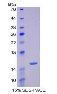 Mouse POSTN / Periostin Protein (Recombinant His)