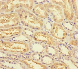 ANKRD33 Antibody