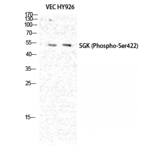 SGK1 / SGK Antibody (350-430 aa)