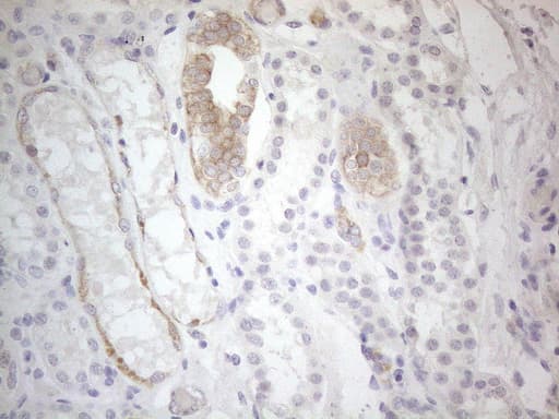 ERBB3 / HER3 Antibody (aa983-1342, clone OTI3C1)