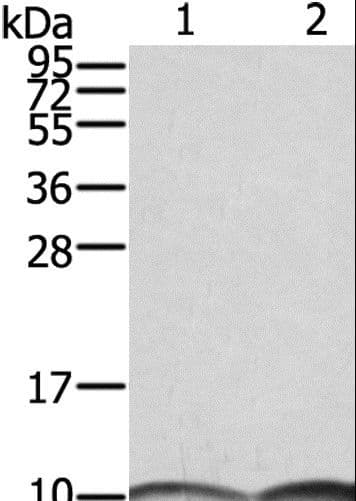 S100A6 / Calcyclin Antibody