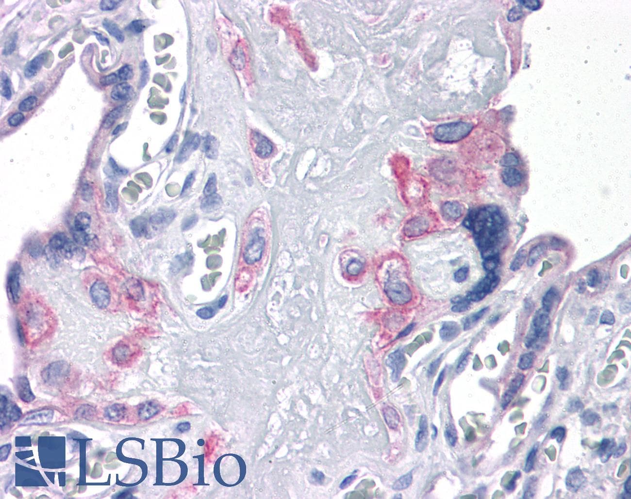 IHC-plus™ Polyclonal Rabbit anti-Human FNIP2 Antibody (IHC, WB)