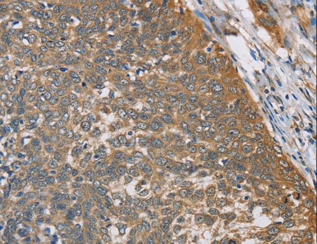 TRAIL-R4 / DCR2 Antibody