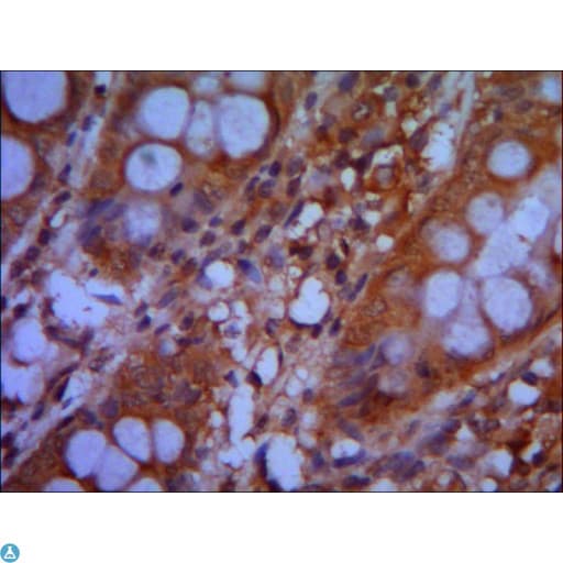 CHD3 Antibody