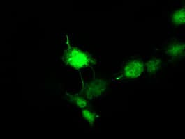 DCX / Doublecortin Antibody (clone OTI4A3)