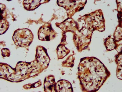 Polyclonal Rabbit anti-Human LRRC45 Antibody (IHC, IF)