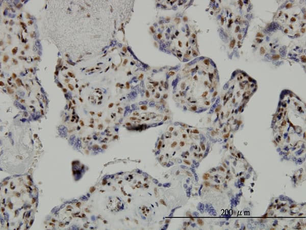 Monoclonal Mouse anti-Human TAF7 Antibody (clone 2C5, IHC, IF, WB)