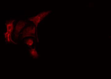 PPP2R5A Antibody