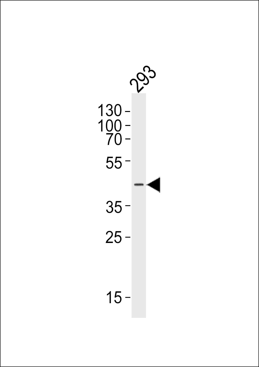Polyclonal Rabbit anti-Human CERKL Antibody (aa94-127, WB)