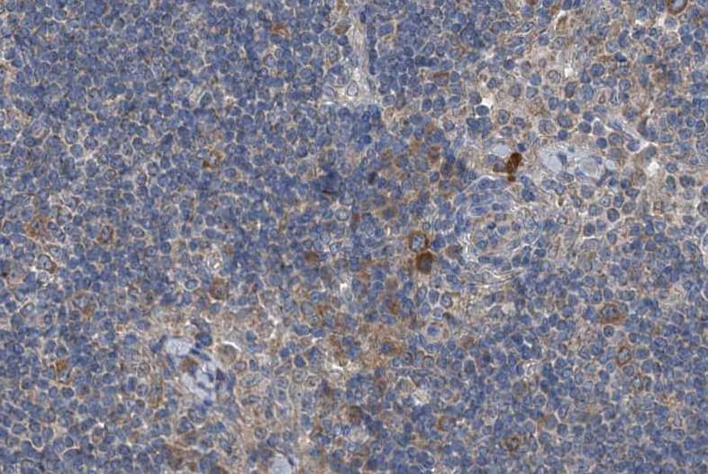 RICK / RIP2 Antibody (phospho-Ser176)