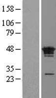FAM50A Protein (Over-Expression Lysate Myc-DDK (Flag))