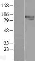 ERCC3 / XPB Protein (Over-Expression Lysate Myc-DDK (Flag))